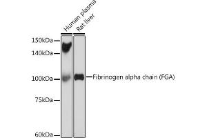 Western blot analysis of extracts of various cell lines, using Fibrinogen alpha chain (FGA) (FGA) Rabbit mAb (ABIN7267177) at 1:1000 dilution. (FGA antibody)