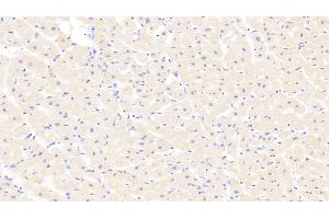 Detection of MYH1 in Human Cardiac Muscle Tissue using Polyclonal Antibody to Myosin Heavy Chain 1 (MYH1) (MYH1 antibody  (AA 585-794))