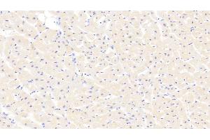 Detection of MYH1 in Human Cardiac Muscle Tissue using Polyclonal Antibody to Myosin Heavy Chain 1 (MYH1) (MYH1 antibody  (AA 585-794))