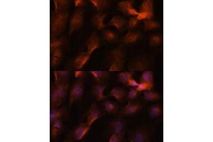 Immunofluorescence analysis of C6 cells using BRC antibody (1034) at dilution of 1:100. (BRCA1 antibody  (AA 400-699))