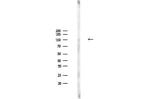 anti-ATPase, H+ Transporting, Lysosomal V0 Subunit A4 (ATP6V0A4) antibody
