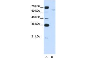 Western Blotting (WB) image for anti-Cytoplasmic Polyadenylation Element Binding Protein 2 (CPEB2) antibody (ABIN2462355) (CPEB2 antibody)