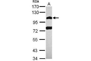 WB Image Sample (30 ug of whole cell lysate) A: A549 7. (POM121 antibody  (N-Term))