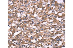 Immunohistochemistry (IHC) image for anti-Spastin (SPAST) antibody (ABIN2822462) (Spastin antibody)