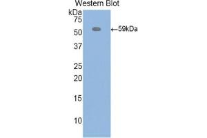 Detection of Recombinant ITIH4, Rat using Polyclonal Antibody to Inter Alpha-Globulin Inhibitor H4 (ITIH4) (ITIH4 antibody  (AA 478-722))