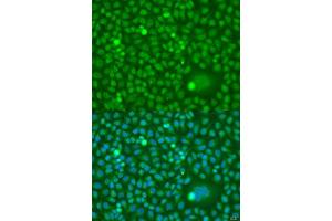 Immunofluorescence analysis of U2OS cells using CDK10 antibody. (CDK10 antibody  (AA 1-283))