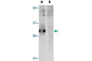 Western blot analysis of SYPL2 in human spleen tissue lysate with SYPL2 polyclonal antibody  at 1 ug/mL in (A) the absence and (B) the presence of blocking peptide. (SYPL2 antibody  (C-Term))