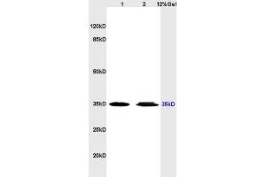 Lane 1: human colon carcinoma lysates Lane 2: human gastric carcinoma lysates probed with Anti ADORA3 Polyclonal Antibody, Unconjugated (ABIN673629) at 1:200 in 4C. (Adenosine A3 Receptor antibody  (AA 85-180))