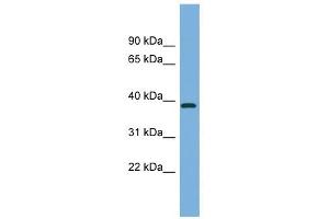FBP2 antibody used at 1 ug/ml to detect target protein. (FBP2 antibody  (Middle Region))