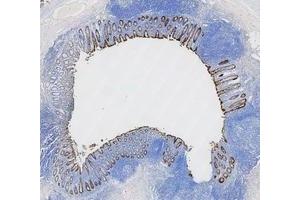IHC analysis of Cytokeratin 8/KRT8 using anti-Cytokeratin 8/KRT8 antibody (ABIN5518853). (KRT8 antibody  (AA 107-325))