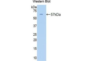 Western blot analysis of the recombinant protein. (COL3A1 antibody  (AA 1059-1466))