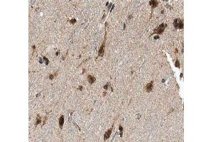 ABIN6266901 at 1/100 staining human brain tissue sections by IHC-P. (FHIT antibody  (Internal Region))