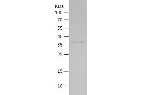 ITFG1 Protein (AA 250-346) (His-IF2DI Tag)