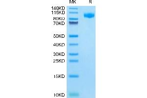 CSF3R Protein (AA 26-626) (His tag)