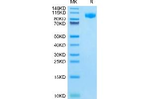 Mouse G-CSF R on Tris-Bis PAGE under reduced condition. (CSF3R Protein (AA 26-626) (His tag))