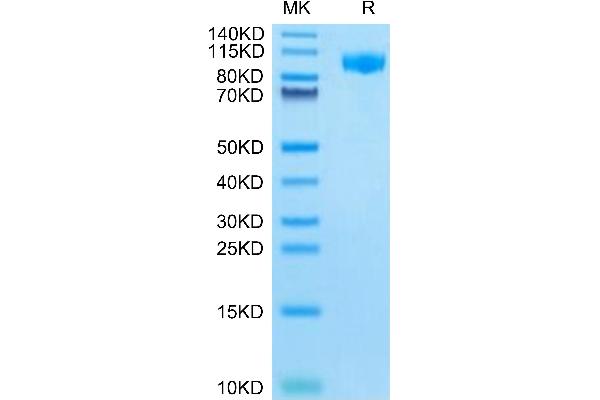 CSF3R Protein (AA 26-626) (His tag)