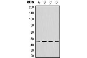 Western blot analysis of GTPBP5 expression in A549 (A), HeLa (B), NS-1 (C), PC12 (D) whole cell lysates.