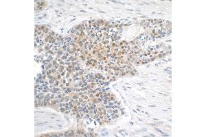 Immunohistochemistry (IHC) image for anti-Meningioma Expressed Antigen 5 (Hyaluronidase) (MGEA5) (AA 500-550) antibody (ABIN7453549)
