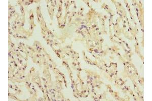 Immunohistochemistry of paraffin-embedded human lung tissue using ABIN7148104 at dilution of 1:100
