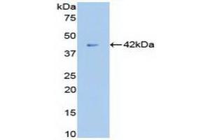 Detection of Recombinant b2M, Canine using Polyclonal Antibody to Beta-2-Microglobulin (b2M) (beta-2 Microglobulin antibody  (AA 1-125))