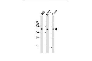 All lanes : Anti-PLIN3 Antibody at 1:2000 dilution Lane 1: Hela whole cell lysate Lane 2: K562 whole cell lysate Lane 3: Daudi whole cell lysate Lysates/proteins at 20 μg per lane.