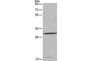Western blot analysis of 231 cell, using ASGR1 Polyclonal Antibody at dilution of 1:300 (Asialoglycoprotein Receptor 1 antibody)