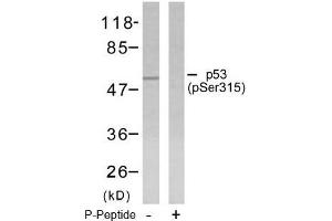 Image no. 1 for anti-Tumor Protein P53 (TP53) (pSer315) antibody (ABIN196788)