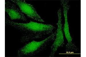 Immunofluorescence of monoclonal antibody to LMO3 on HeLa cell. (LMO3 antibody  (AA 91-146))