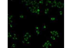 Immunofluorescence staining of Hela cells with ABIN7150422 at 1:100, counter-stained with DAPI. (POLR2A/RPB1 antibody  (AA 76-298))