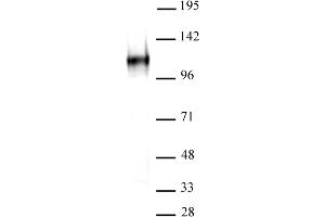 BCL11A antibody (mAb) tested by Western blot. (BCL11A antibody  (AA 637-835))