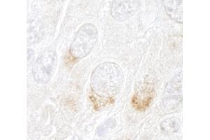 Immunohistochemistry (IHC) image for anti-Golgi Brefeldin A Resistant Guanine Nucleotide Exchange Factor 1 (GBF1) (AA 1809-1859) antibody (ABIN7448578)