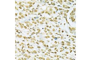 Immunohistochemistry (Paraffin-embedded Sections) (IHC (p)) image for anti-Heterogeneous Nuclear Ribonucleoprotein A2/B1 (HNRNPA2B1) (AA 1-180) antibody (ABIN3021593)