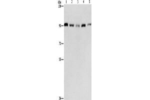 Western Blotting (WB) image for anti-Minichromosome Maintenance Complex Component 5 (MCM5) antibody (ABIN2421834) (MCM5 antibody)