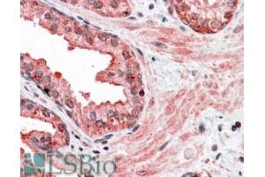 ABIN184871 (3. (CCNDBP1 antibody  (C-Term))