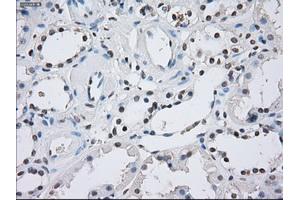 Immunohistochemical staining of paraffin-embedded Kidney tissue using anti-ILF2mouse monoclonal antibody.