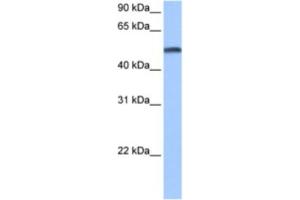 Western Blotting (WB) image for anti-Cytochrome P450, Family 1, Subfamily B, Polypeptide 1 (CYP1B1) antibody (ABIN2463468) (CYP1B1 antibody)