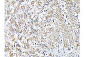 Immunohistochemistry (Paraffin-embedded Sections) (IHC (p)) image for anti-SNAIL (SNAI1) (AA 1-264) antibody (ABIN6148175)