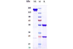 Anti-IGF1R / CD221 Reference Antibody (teprotumumab) on SDS-PAGE under reducing (R) condition. (Recombinant IGF1R (Teprotumumab Biosimilar) antibody)