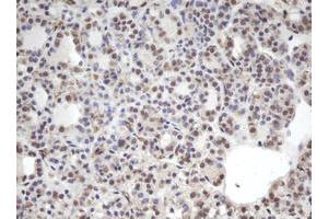 Image no. 1 for anti-Chromobox Homolog 8 (CBX8) (AA 1-260) antibody (ABIN1490659) (CBX8 antibody  (AA 1-260))