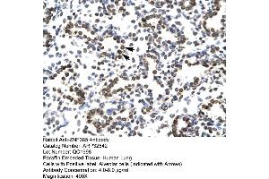 Human Lung (ZNF385A antibody  (N-Term))
