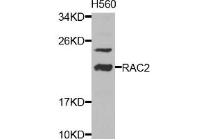 Western blot analysis of extracts of HL-60 cells, using RAC2 antibody. (RAC2 antibody)