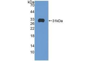 Detection of Recombinant ITGb5, Human using Polyclonal Antibody to Integrin Beta 5 (ITGb5) (Integrin beta 5 antibody  (AA 137-378))