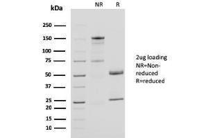 SDS-PAGE Analysis Purified CD40L Mouse Monoclonal Antibody (CD40LG/2761). (CD40 Ligand antibody  (AA 108-261))