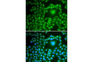 Immunofluorescence analysis of U2OS cells using PP1 beta antibody . (PPP1CB antibody  (AA 1-327))