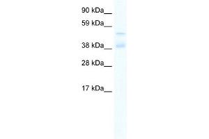 WB Suggested Anti-ZNF17 Antibody Titration:  0.