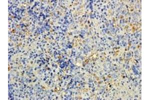 IHC staining of FFPE rat spleen with MTMR9 antibody at 5ug/ml. (MTMR9 antibody)
