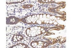 Immunohistochemistry analysis of paraffin-embedded human colon using PERK Polyclonal Antibody at dilution of 1:500. (PERK antibody)