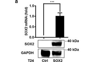 SOX2 mediates growth of bladder cancer cells. (SOX2 antibody)