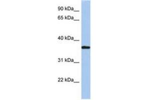 Image no. 1 for anti-Low Density Lipoprotein Receptor Adaptor Protein 1 (LDLRAP1) (AA 35-84) antibody (ABIN6743822) (LDLRAP1 antibody  (AA 35-84))
