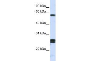 WB Suggested Anti-HABP2 Antibody Titration: 0. (HABP2 antibody  (Middle Region))